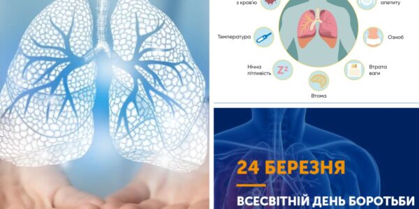 xr:d:DAF_9cfy5VI:8,j:728879413480551148,t:24031914